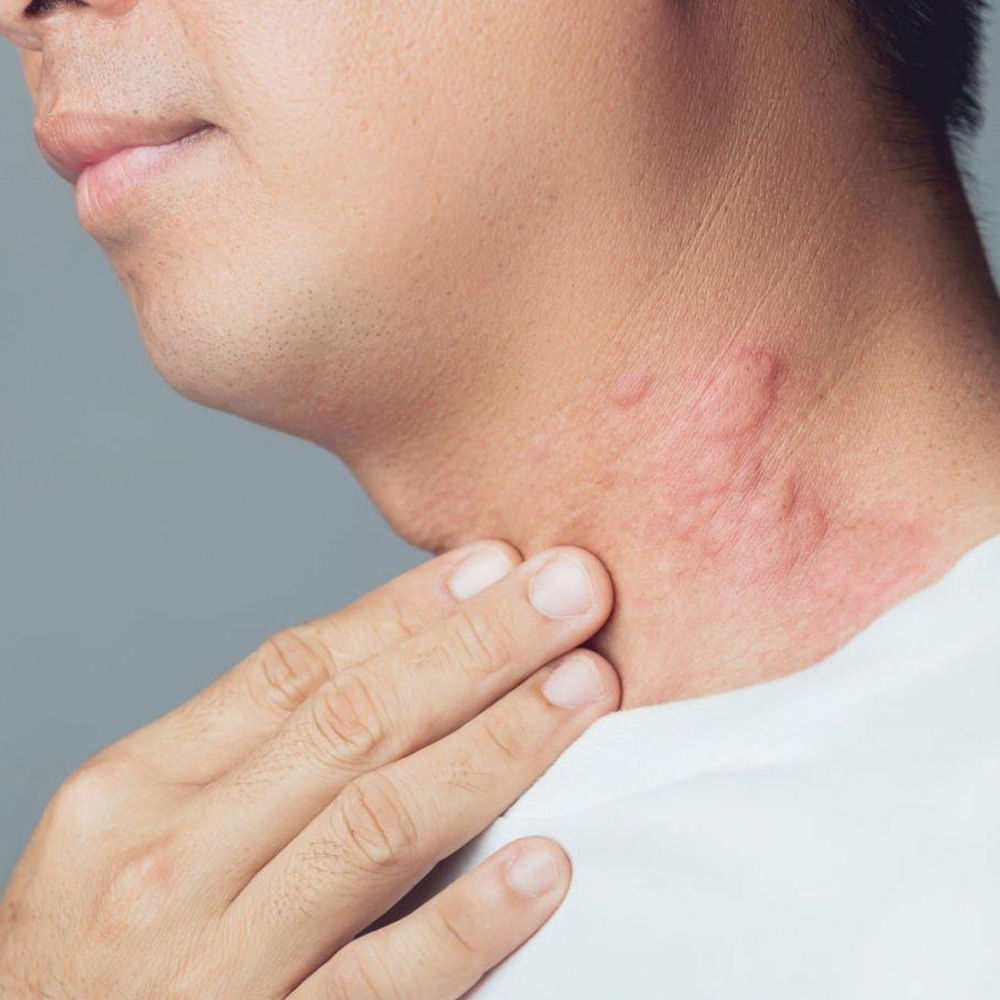 Skin Problem Management