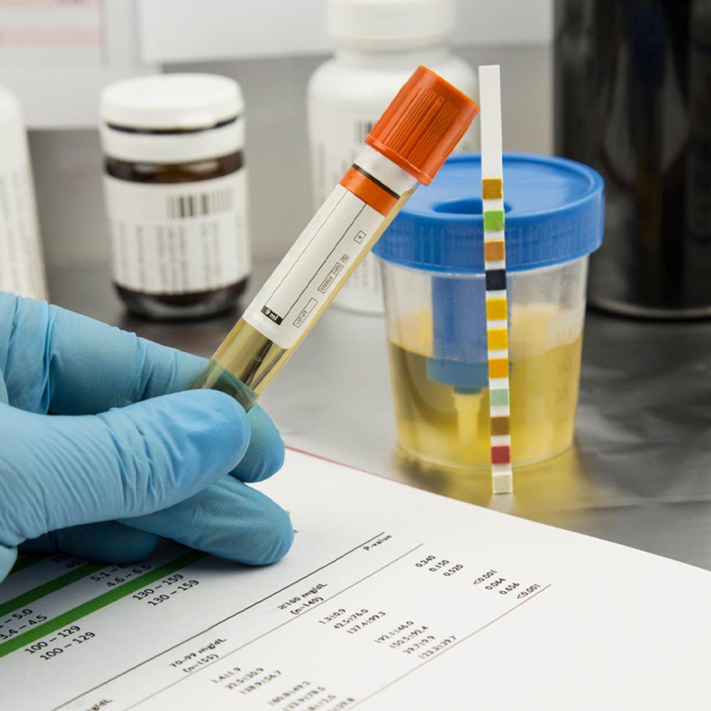 Rapid Tests